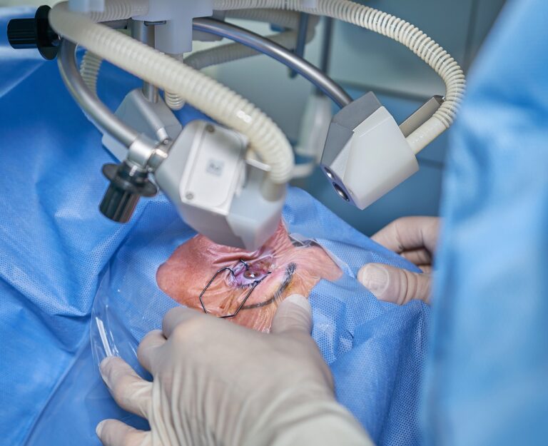 kataraktchirurgie lasik, laser augenzentrum
